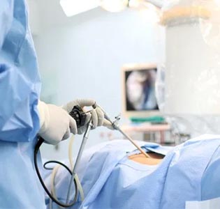 LAPAROSCOPIC SURGERY